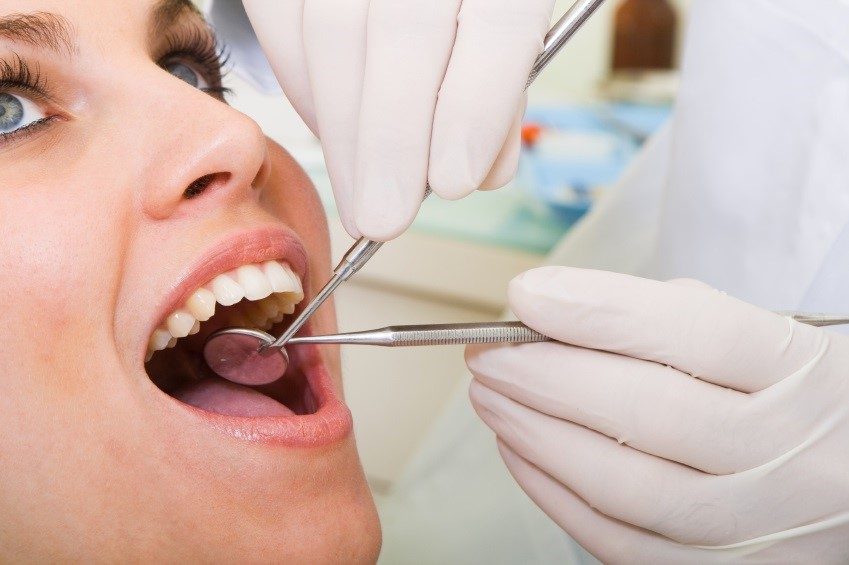 What to Expect at a Dental Check-Up in Gandhinagar at Nova Dental Hospital, Gandhinagar