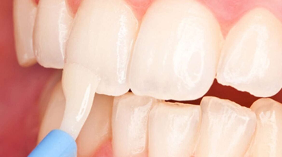 Fluoride Treatments for Children: Do They Really Help and Are They Safe?