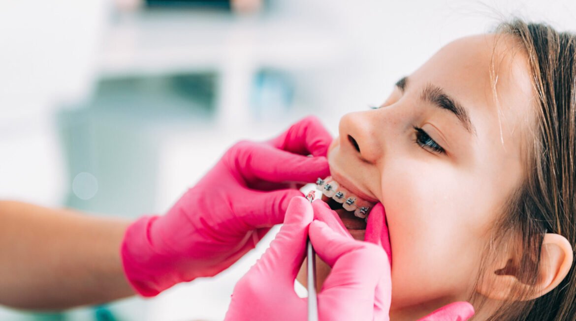 Orthodontics for Children in Gandhinagar: When Is the Right Age to Start?