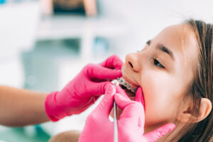 Orthodontics for Children in Gandhinagar: When Is the Right Age to Start?
