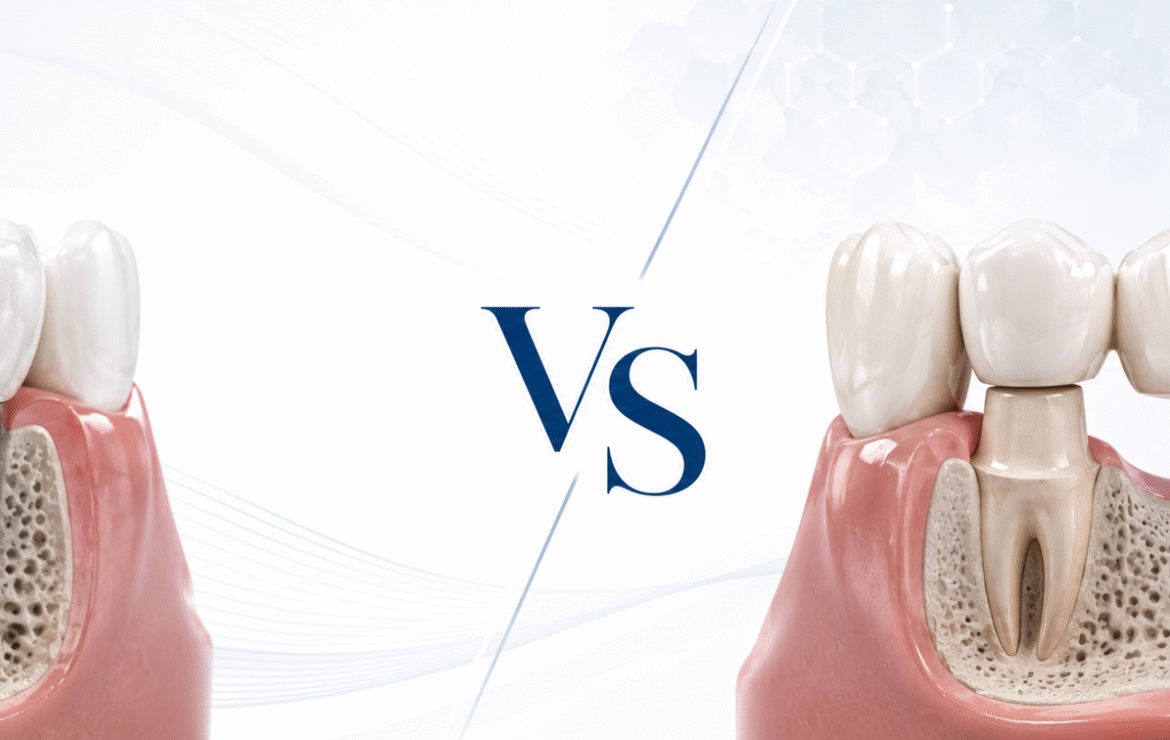 Dental implant vs dental bridge comparison for replacing one missing tooth