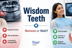 Wisdom Teeth in Gandhinagar: When to Remove vs. When It’s Safe to Watch and Wait