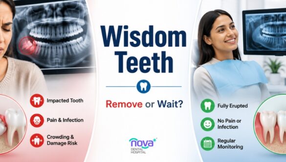 Wisdom Teeth in Gandhinagar: When to Remove vs. When It’s Safe to Watch and Wait