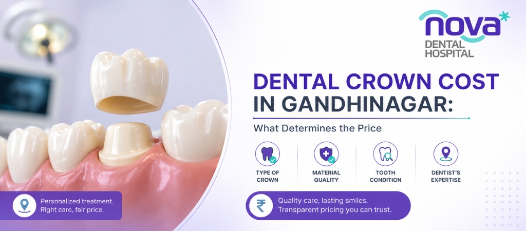 Dental Crown Cost in Gandhinagar: What Determines the Price