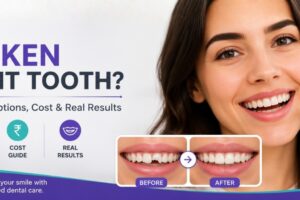 Broken Front Tooth? Treatment Options, Cost & Real Results