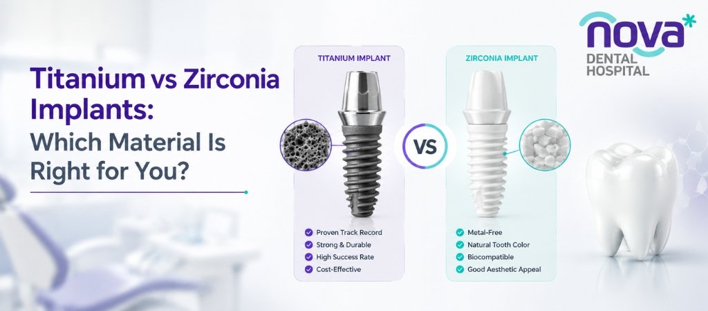 Titanium vs Zirconia Implants: Which Material Is Right for You?