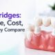 Dental Bridges: Procedure, Cost, and How They Compare to Implants