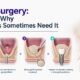 Sinus Lift Surgery: What It Is and Why Upper Implants Sometimes Need It