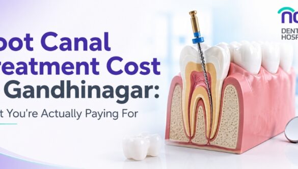 Root Canal Treatment Cost in Gandhinagar: What You’re Actually Paying For