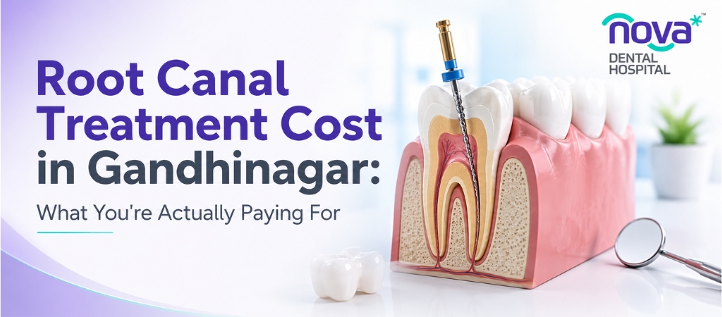 Root Canal Treatment Cost in Gandhinagar: What You’re Actually Paying For