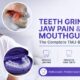 Teeth Grinding, Jaw Pain & Mouthguards: The Complete TMJ-Bruxism Guide