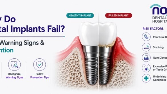 Why Do Dental Implants Fail? Risks, Warning Signs & Prevention