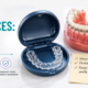 Retainers After Braces: How Long Do You Really Need to Wear Them?