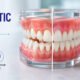 Orthodontic Relapse: Why Teeth Shift Back and How to Prevent It