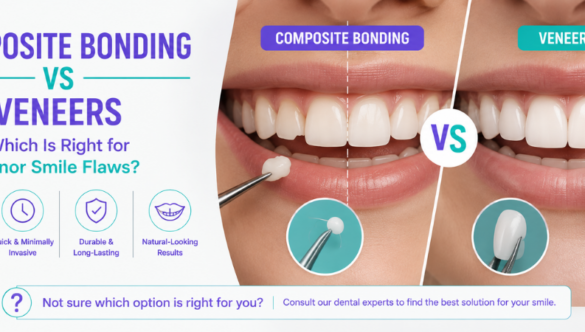 Composite Bonding vs Veneers: Which Is Right for Minor Smile Flaws?