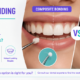 Composite Bonding vs Veneers: Which Is Right for Minor Smile Flaws?
