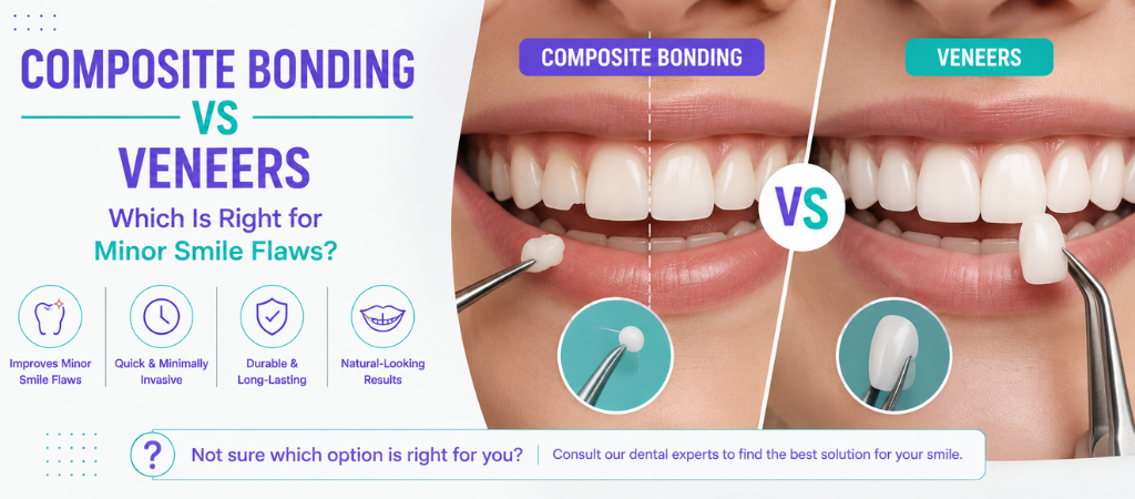Composite Bonding vs Veneers: Which Is Right for Minor Smile Flaws?
