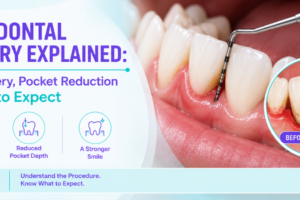 Periodontal Surgery Explained: Flap Surgery, Pocket Reduction & What to Expect