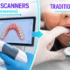 Intraoral Scanners vs Traditional Impressions: Why Digital Scanning Is More Comfortable